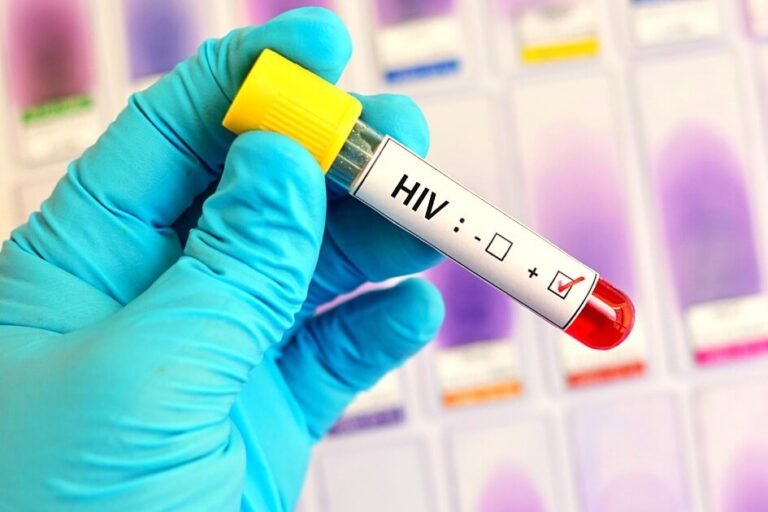 HIV in urdu